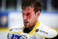 Stefan Gråhns blodig efter slagsmål med Oscar Engsund